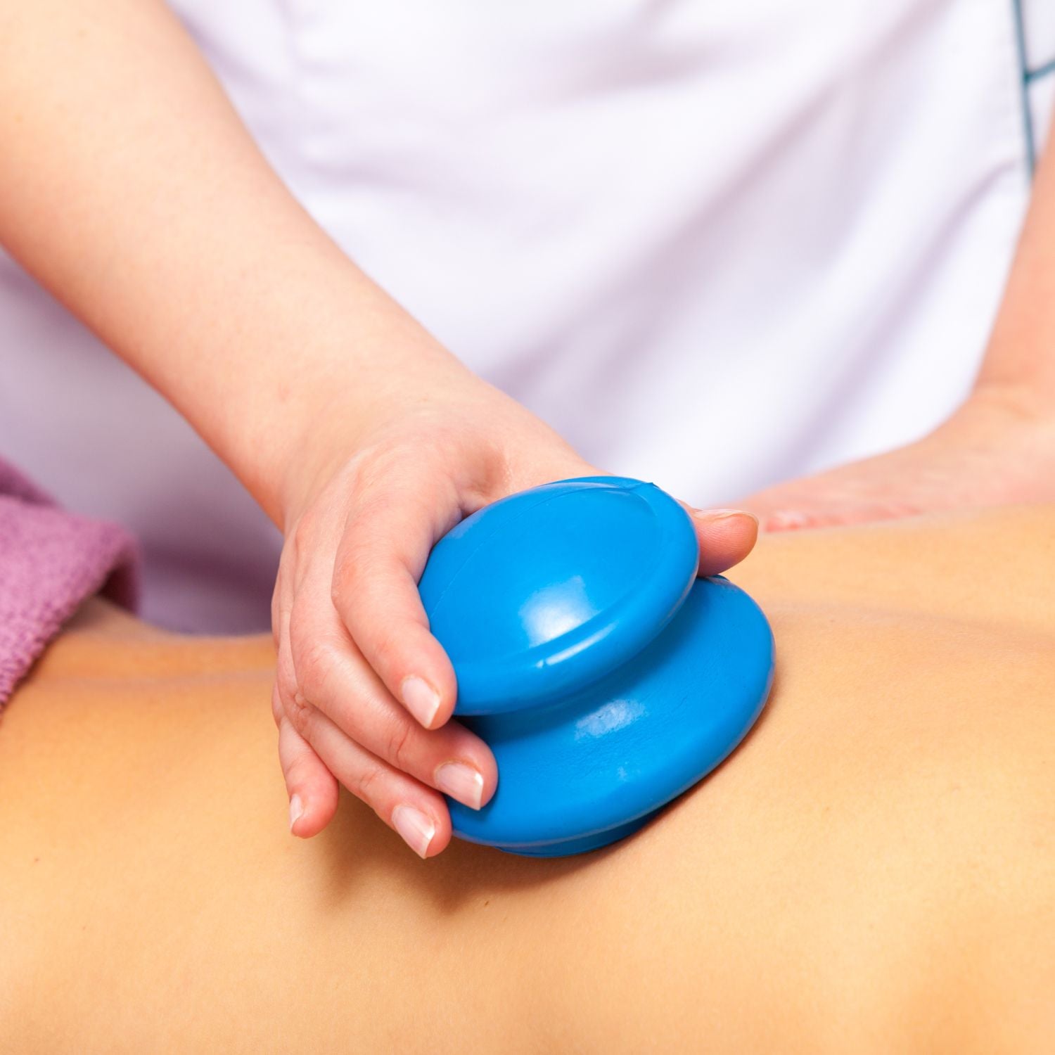 therapist using blue suction cup on someone's back