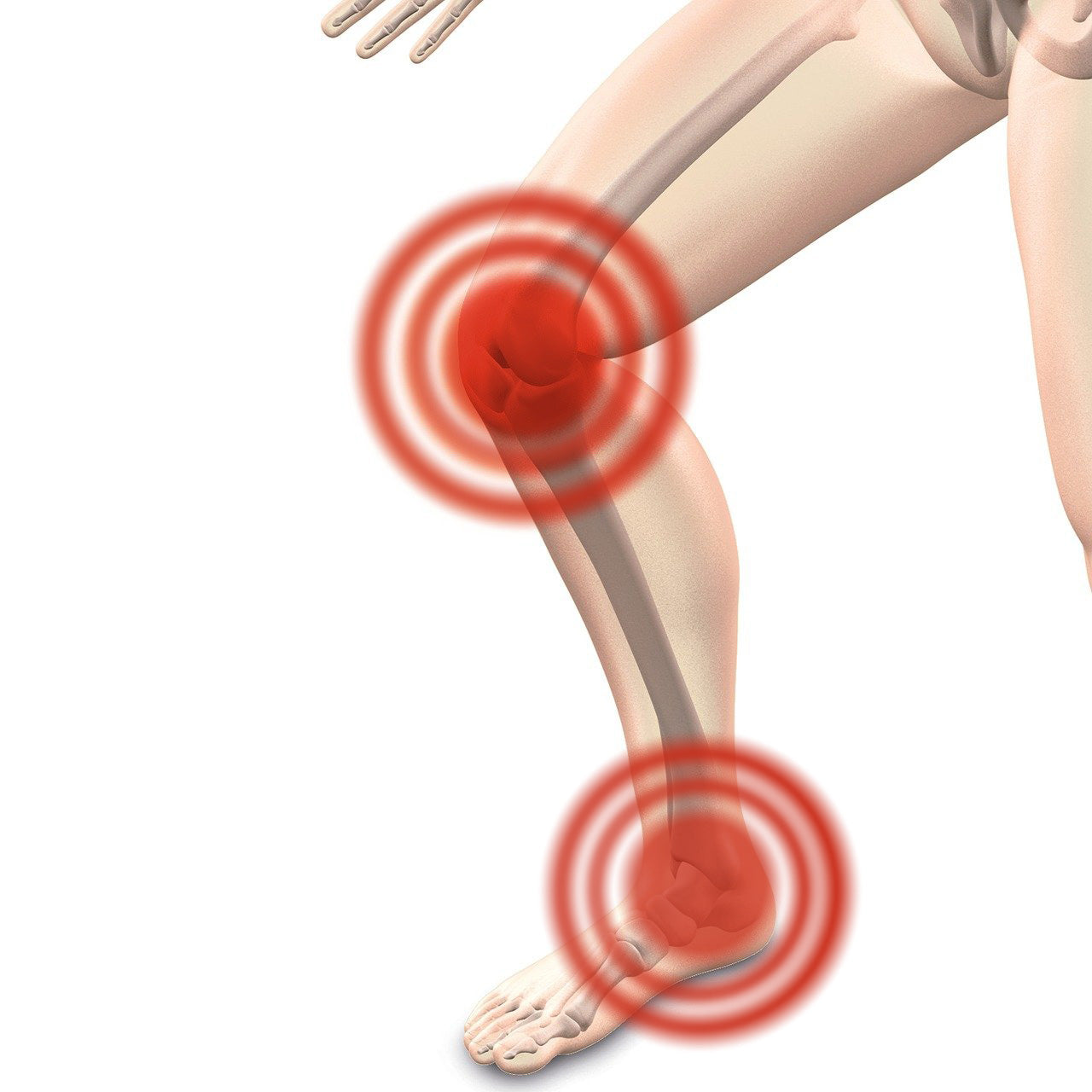 leg bones with red marks around knee and ankle indicating pain