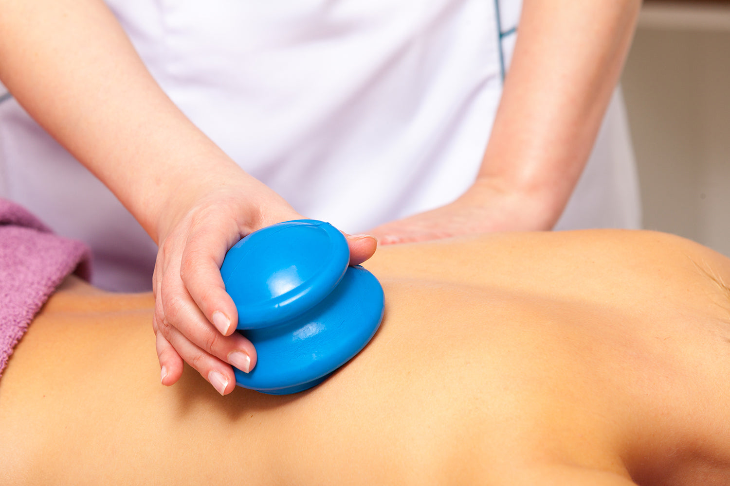 therapist using blue suction cup on someones back